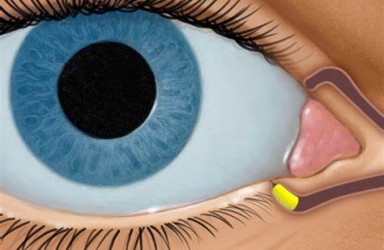 免费治疗|Carteolol治疗原发性开角型青光眼或高眼压症临床试验