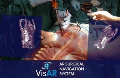 进展|VisAR系统印尼获批用于脊柱手术的增强现实手术导航