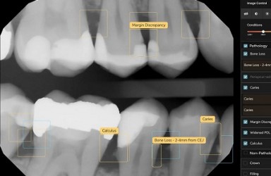 进展|人工智能软件Second Opinion®以色列获批辅助牙科诊疗