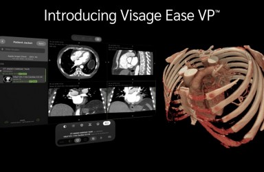 进展|VisageEaseVP三维医学成像在AppleVisionPro平台发布虚拟现实可视化