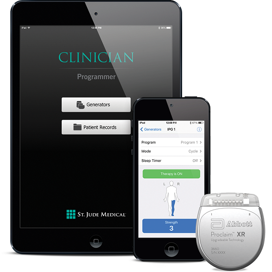 进展Proclaim™Plus脊髓刺激装置美国获批缓解多个疼痛区域 百配健康阅读越健康!