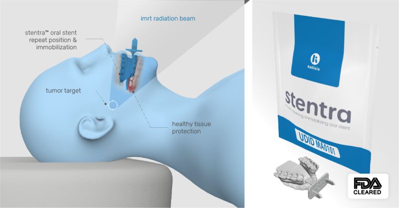 首款|3D打印定制口腔支架Stentra美国获批用于头颈癌(HNC)放疗辅助