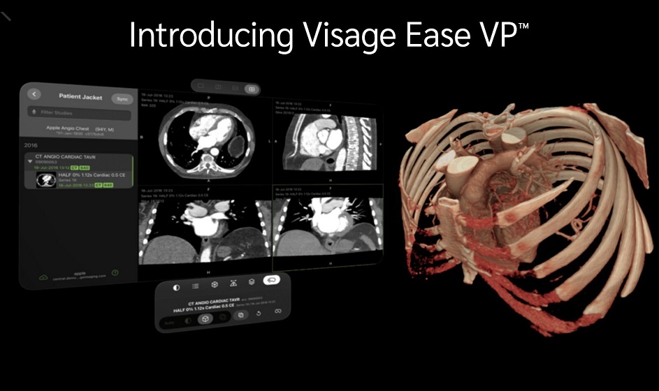 进展|VisageEaseVP三维医学成像在AppleVisionPro平台发布虚拟现实可视化