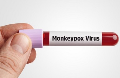 进展|Quest Monkeypox PCR美国获猴痘病毒检测紧急使用授权