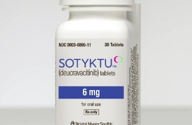新药|Sotyktu(Deucravacitinib)美国获治疗斑块状银屑病
