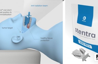 首款|3D打印定制口腔支架Stentra美国获批用于头颈癌(HNC)放疗辅助
