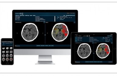 人工智能|Brainomix 360 e-Lung软件美国获批检测肺纤维化